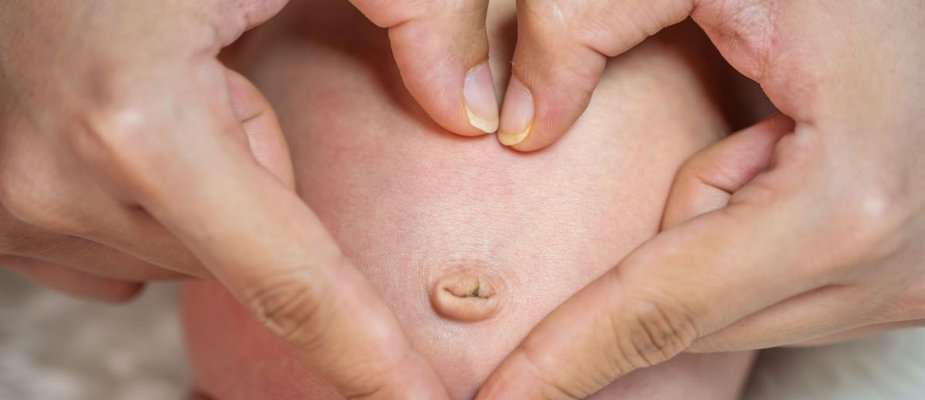 Coto umbilical fases: Como cuidar do umbigo do bebê? Coto umbilical fases: Como cuidar do umbigo do bebê?